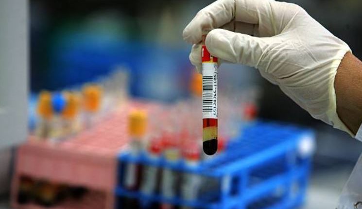 new-blood-test-offers-hope-for-schizophrenia-diagnosis-and-treatment